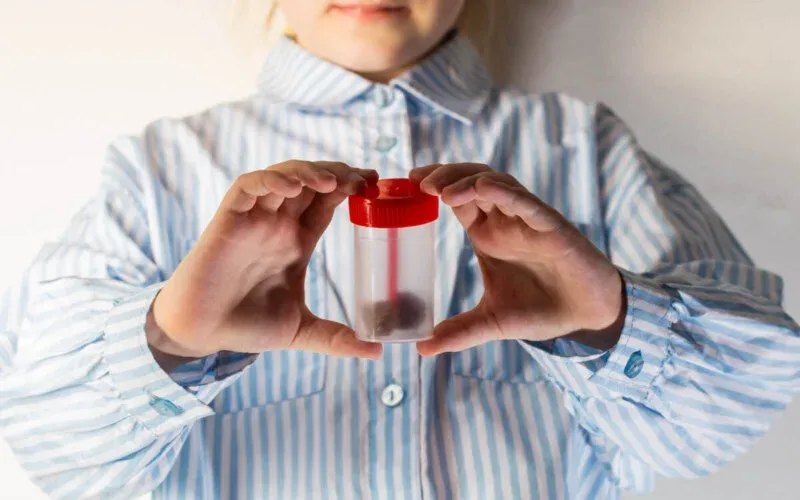 Kaka tahlili için örneği kaç saat içinde teslim etmek gerekiyor?