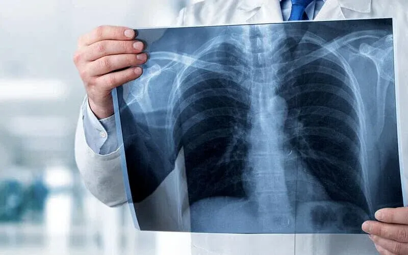 Hamilelikte radyoloji veya diş röntgeni çekilirse bebeğe zarar verir mi?