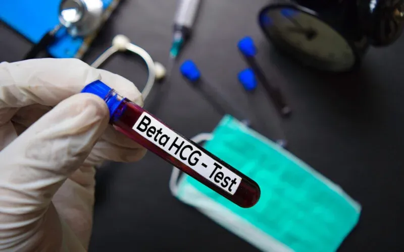 Beta HCG sonucum 0.100 çıktı, acaba hamile olabilir miyim?